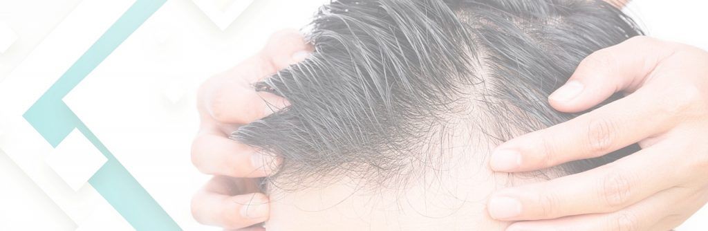 cuidados después de un injerto capilar