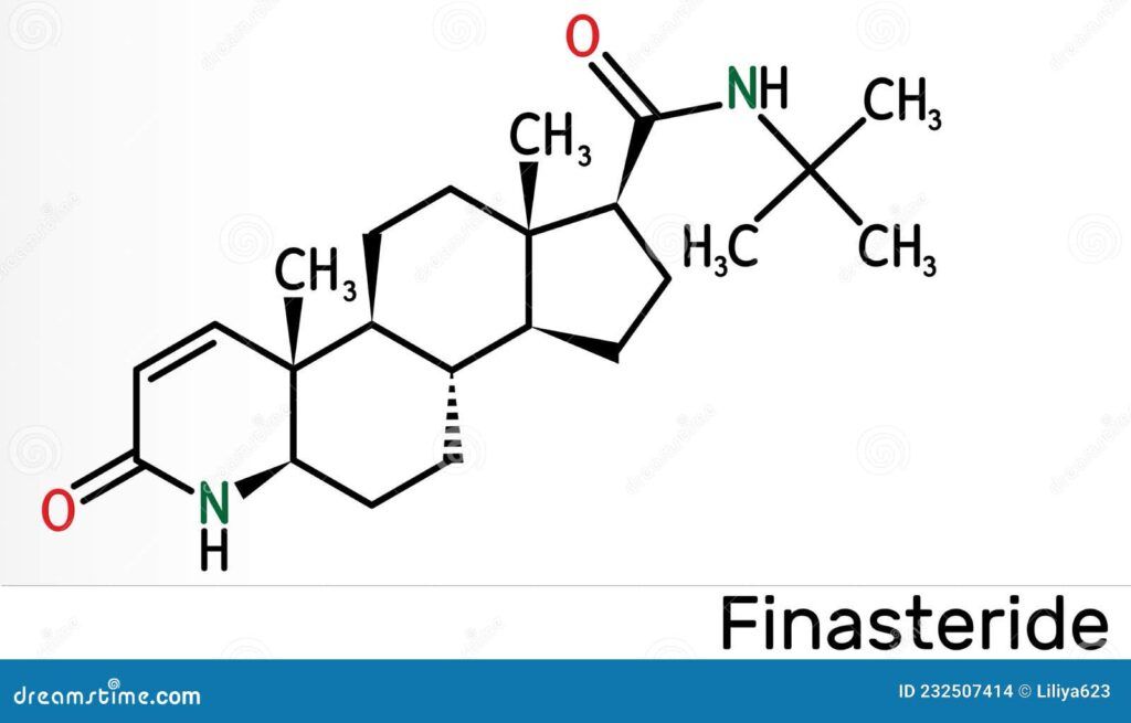 láser capilar vs finasteride