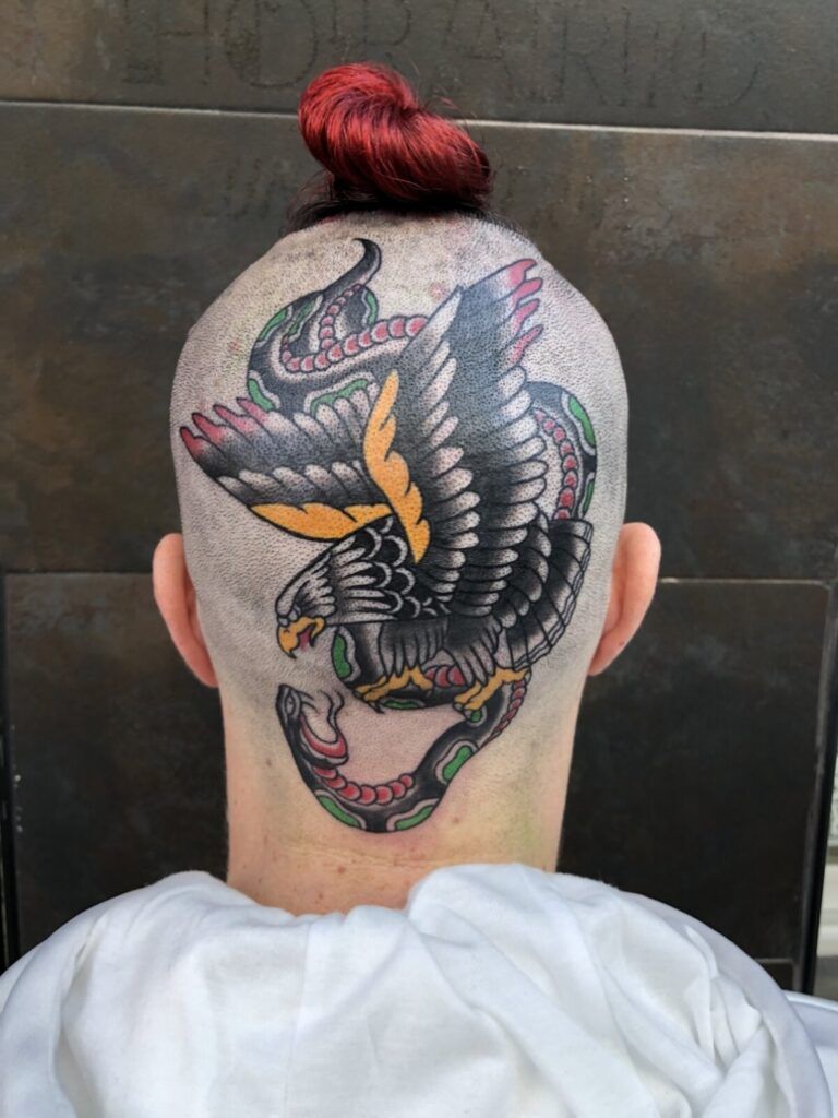 láser capilar en zonas con tatuajes